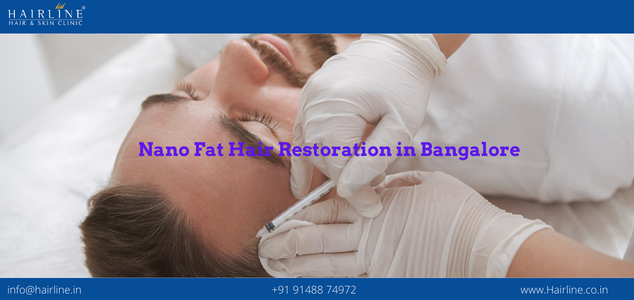 Nano Fat Hair Restoration in Bangalore